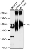 Anti-TNR antibody used in Western Blot (WB). GTX66358