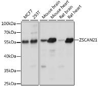 Anti-ZNF38 antibody used in Western Blot (WB). GTX66359