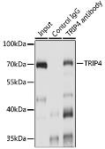 Anti-ASC1 antibody used in Immunoprecipitation (IP). GTX66364