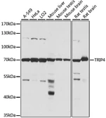 Anti-ASC1 antibody used in Western Blot (WB). GTX66364