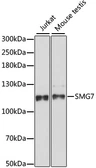 Anti-SMG7 antibody used in Western Blot (WB). GTX66369