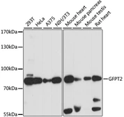 Anti-GFPT2 antibody used in Western Blot (WB). GTX66370