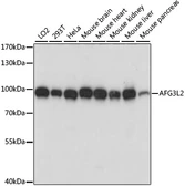 Anti-AFG3L2 antibody used in Western Blot (WB). GTX66373