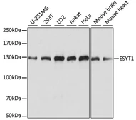 Anti-FAM62A antibody used in Western Blot (WB). GTX66375