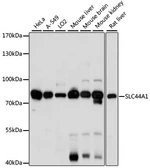 Anti-CD92 antibody used in Western Blot (WB). GTX66376