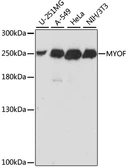Anti-FER1L3 antibody used in Western Blot (WB). GTX66378