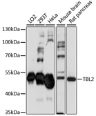Anti-TBL2 antibody used in Western Blot (WB). GTX66379