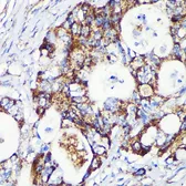 Anti-CCDC44 antibody used in IHC (Paraffin sections) (IHC-P). GTX66382