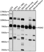 Anti-PGM2 antibody used in Western Blot (WB). GTX66383