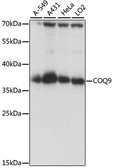 Anti-COQ9 antibody used in Western Blot (WB). GTX66385