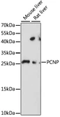 Anti-PCNP antibody used in Western Blot (WB). GTX66386