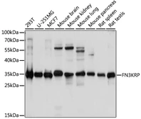 Anti-FN3KRP antibody used in Western Blot (WB). GTX66387