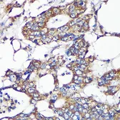 Anti-SLIRP antibody used in IHC (Paraffin sections) (IHC-P). GTX66390