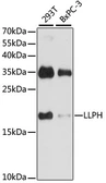 Anti-LLPH antibody used in Western Blot (WB). GTX66393