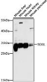 Anti-SDSL antibody used in Western Blot (WB). GTX66395