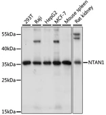 Anti-NTAN1 antibody used in Western Blot (WB). GTX66399
