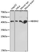 Anti-HEXIM2 antibody used in Western Blot (WB). GTX66400
