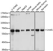 Anti-LRWD1 antibody used in Western Blot (WB). GTX66401