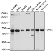 Anti-LRWD1 antibody used in Western Blot (WB). GTX66401