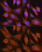 Anti-Glutathione S Transferase theta 2 antibody used in Immunocytochemistry/ Immunofluorescence (ICC/IF). GTX66403