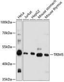 Anti-TRIM5 antibody used in Western Blot (WB). GTX66410
