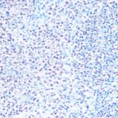 Anti-SNRPB antibody used in IHC (Paraffin sections) (IHC-P). GTX66411