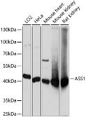 Anti-ASS1 antibody used in Western Blot (WB). GTX66412