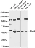 Anti-Urokinase antibody used in Western Blot (WB). GTX66413