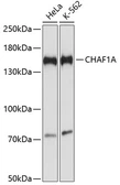 Anti-CHAF1A antibody used in Western Blot (WB). GTX66415