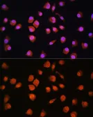 Anti-NPL4 antibody used in Immunocytochemistry/ Immunofluorescence (ICC/IF). GTX66423