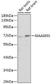 Anti-KIAA0391 antibody used in Western Blot (WB). GTX66424