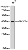 Anti-ATP6V0D1 antibody used in Western Blot (WB). GTX66439