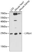 Anti-LYPLA1 antibody used in Western Blot (WB). GTX66442