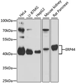 Anti-TXNDC4 antibody used in Western Blot (WB). GTX66444