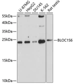 Anti-Pallidin antibody used in Western Blot (WB). GTX66447