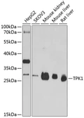 Anti-TPK1 antibody used in Western Blot (WB). GTX66448