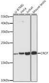 Anti-CRCP antibody used in Western Blot (WB). GTX66450