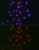 Anti-TDP1 antibody used in Immunocytochemistry/ Immunofluorescence (ICC/IF). GTX66457