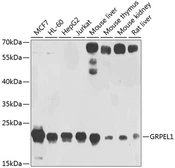 Anti-GRPEL1 antibody used in Western Blot (WB). GTX66460
