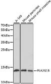 Anti-PLA2G1B antibody used in Western Blot (WB). GTX66466