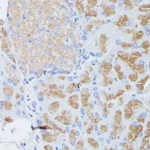 Anti-PLA2G1B antibody used in IHC (Paraffin sections) (IHC-P). GTX66466