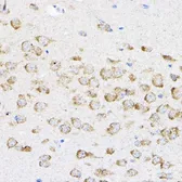 Anti-RPL4 antibody used in IHC (Paraffin sections) (IHC-P). GTX66468