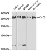 Anti-CHD2 antibody used in Western Blot (WB). GTX66469