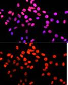 Anti-MATR3 antibody used in Immunocytochemistry/ Immunofluorescence (ICC/IF). GTX66470