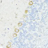 Anti-RPL10A antibody used in IHC (Paraffin sections) (IHC-P). GTX66471