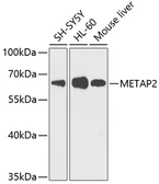Anti-METAP2 antibody used in Western Blot (WB). GTX66473