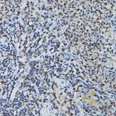 Anti-PRPF4 antibody used in IHC (Paraffin sections) (IHC-P). GTX66476