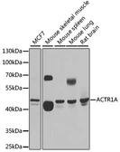 Anti-ACTR1A antibody used in Western Blot (WB). GTX66477