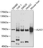 Anti-ALAS-H antibody used in Western Blot (WB). GTX66478