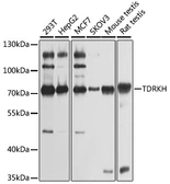 Anti-TDRKH antibody used in Western Blot (WB). GTX66482
